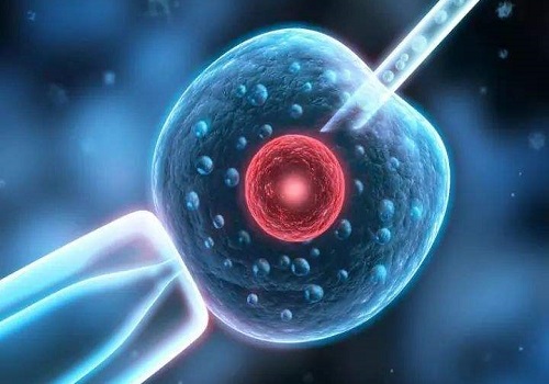 想到俄羅斯做第三代的試管嬰兒要多少的費(fèi)用