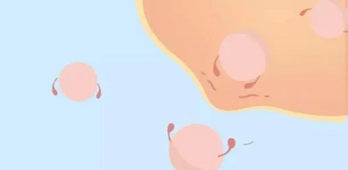 到泰國(guó)試管嬰兒需要做好哪些手續(xù)