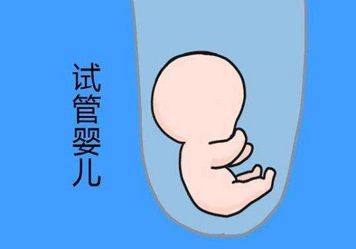 俄羅斯試管嬰兒流程
