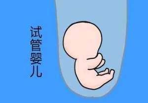 俄羅斯試管嬰兒流程